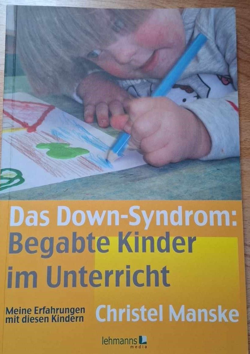 Das Down-Syndrom Das Down-Syndrom