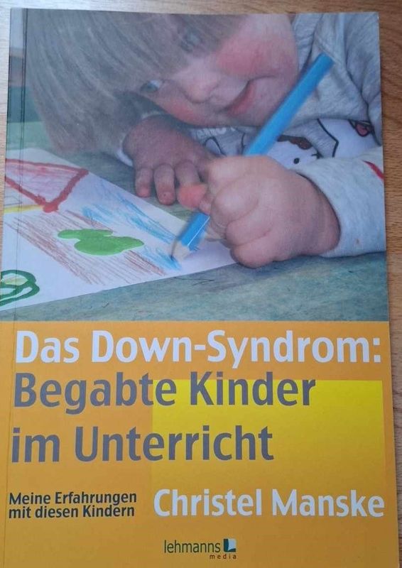 Das Down-Syndrom Das Down-Syndrom