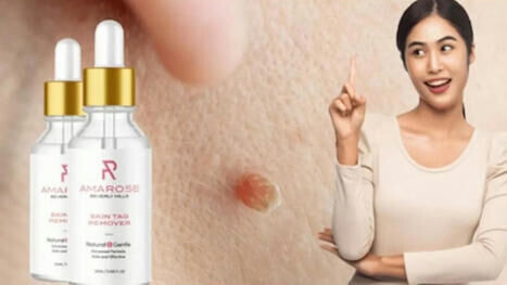 Perfect 10 Skin Tag Remover Reviews