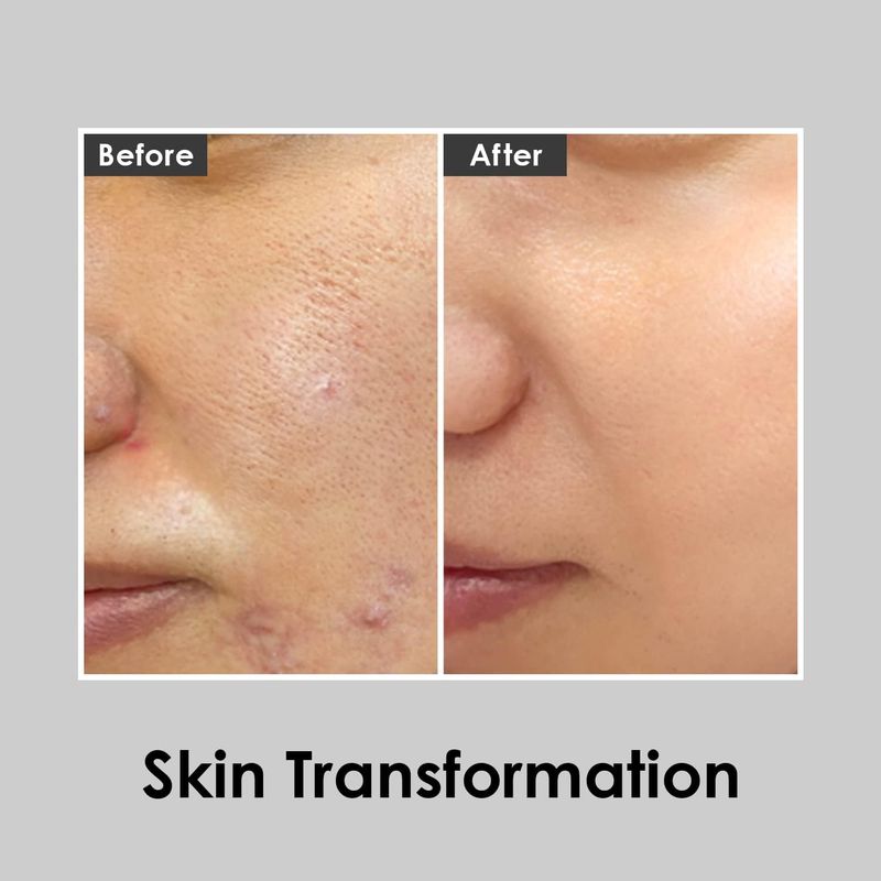 Medi-Peel Peptide 9 Aqua Essence Toner