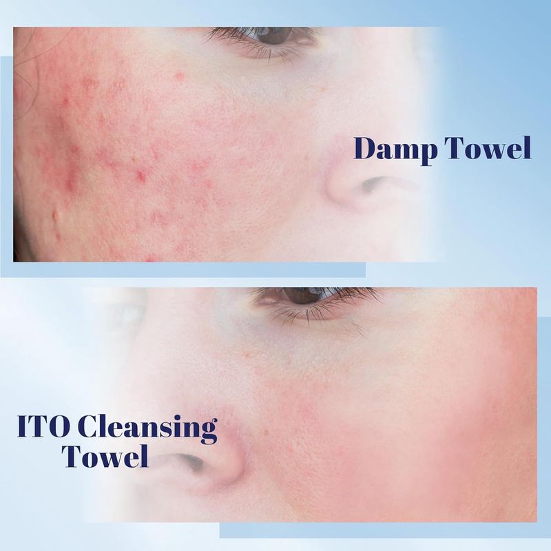 ITO Cleansing Towel