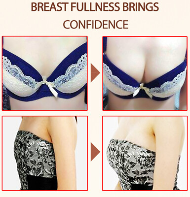 Mango Breast Enlargement Cream Elasticity Firming Lifting Enhancing - UK SELLER