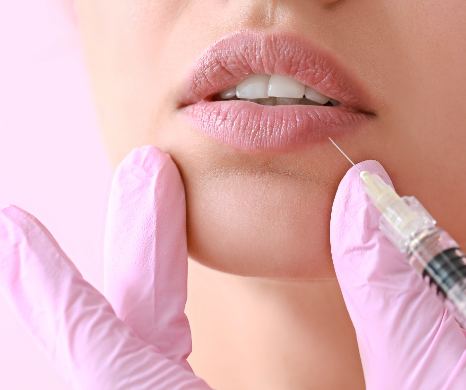 Dermal lip filler
