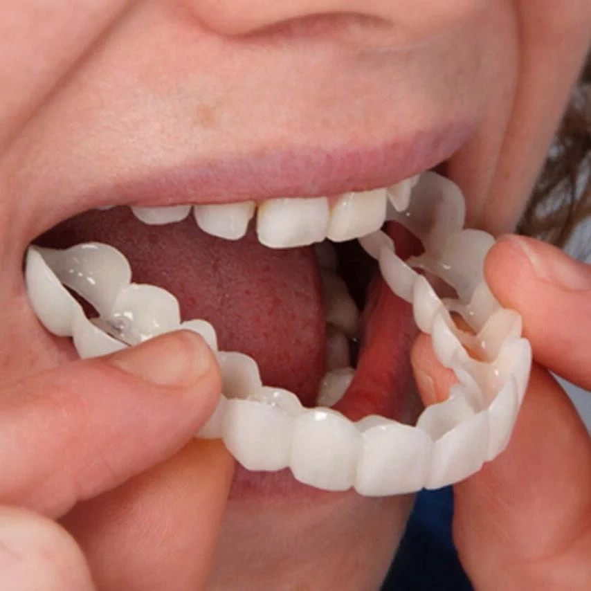 Denture Upper &amp; Lower - Instant Veneers™