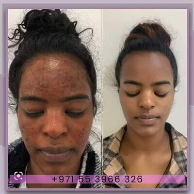 NATURAL SKINCARE PRODUCTS