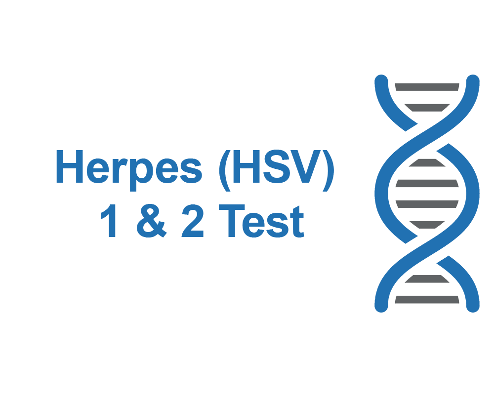 Herpes (HSV) 1 &amp; 2 Test