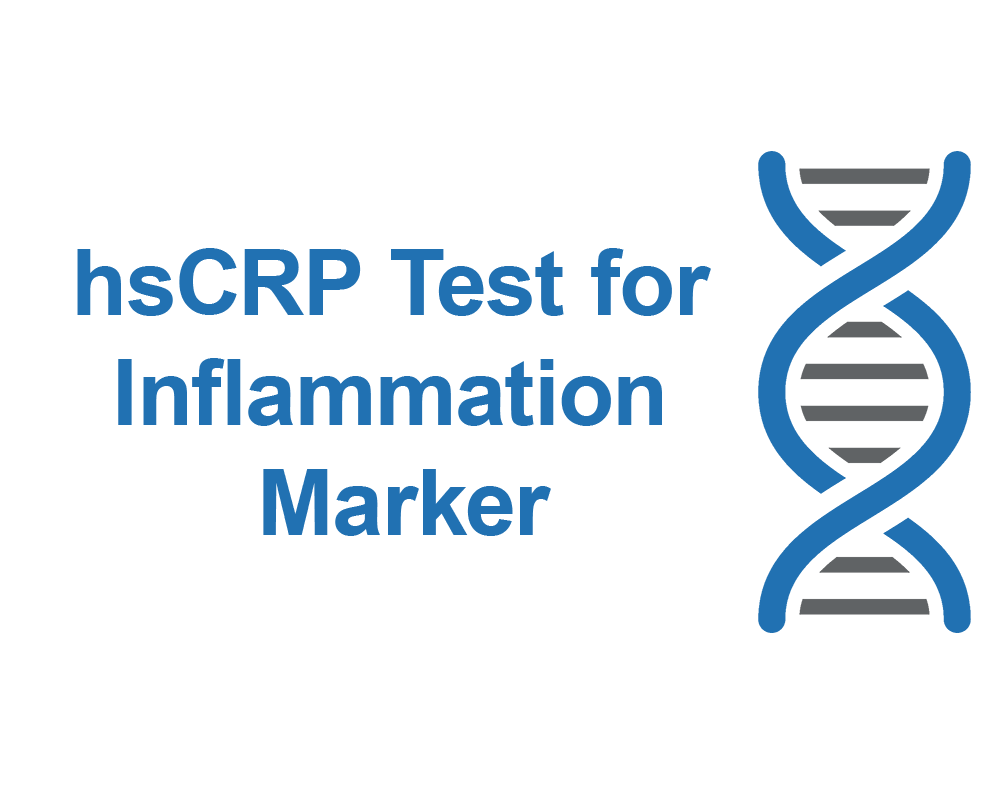 hsCRP Test for Inflammation Marker