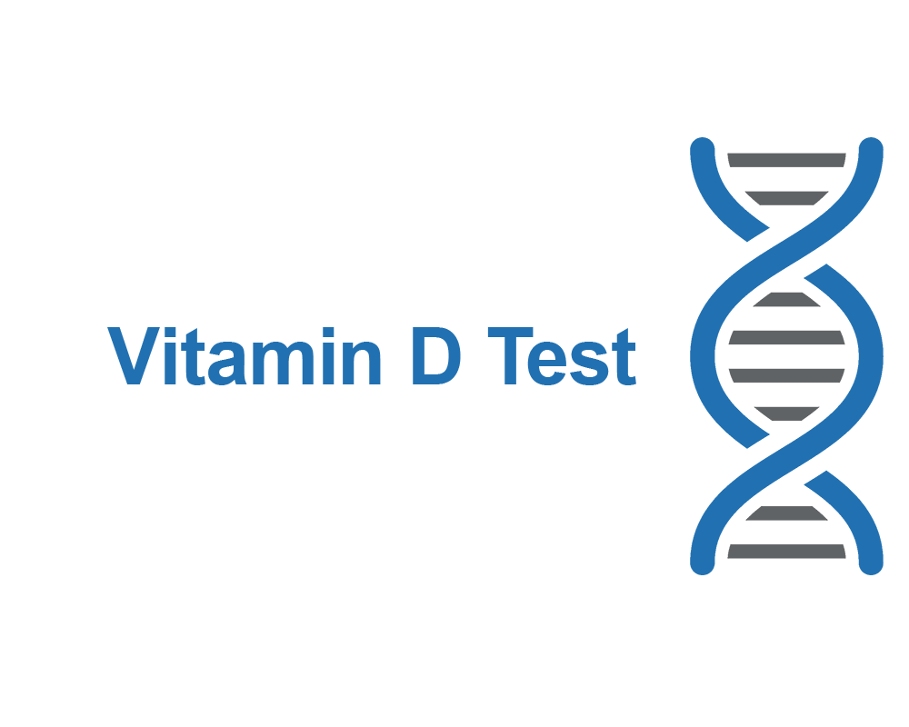 Vitamin D Test