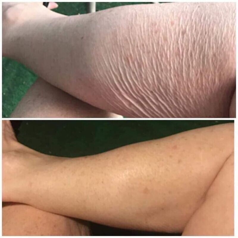 Dermatic Effects cellulite firming Cream