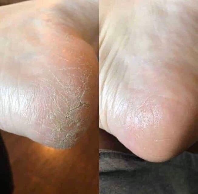 Sole Solutions