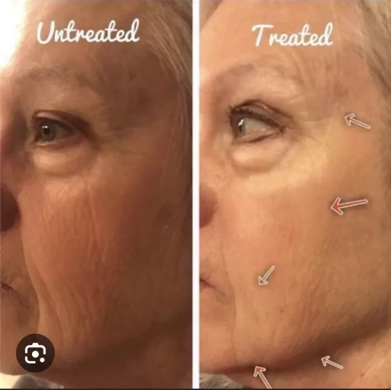 TruFace Uplifting Cream