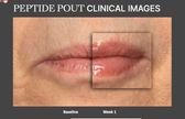 Peptide Pout