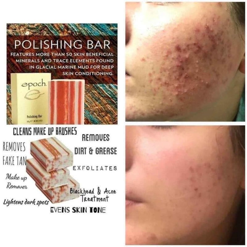 Epoch Polishing Bar
