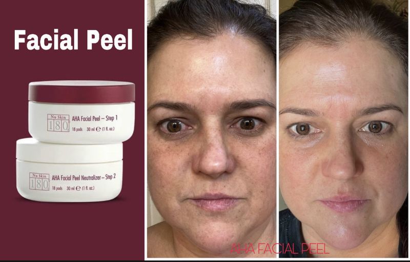 AHA Facial Peel