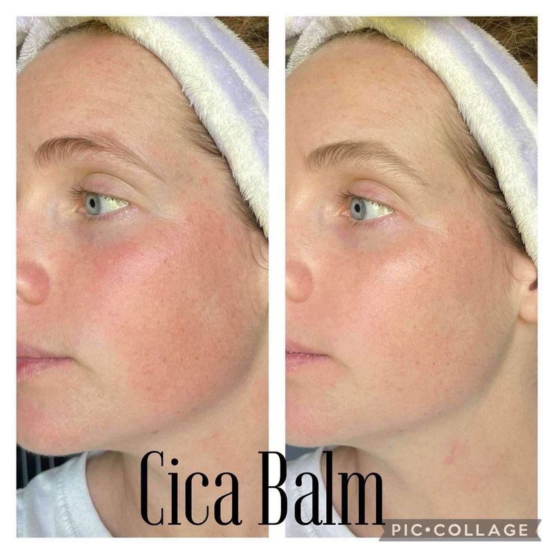 Cica Balm
