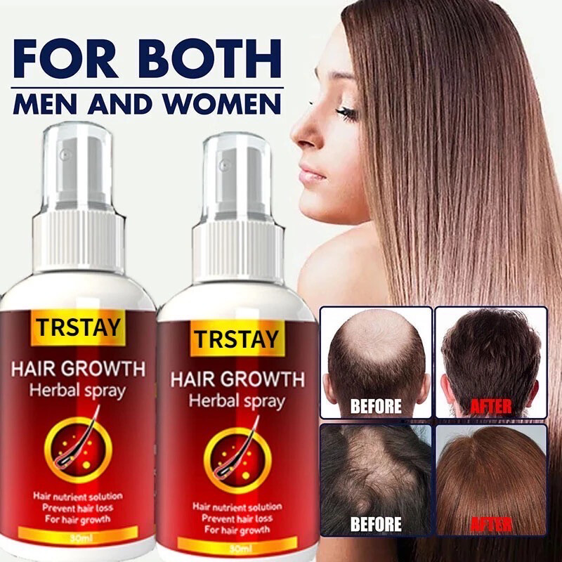 Hair Growth Serum Spray Fast Hair Growth