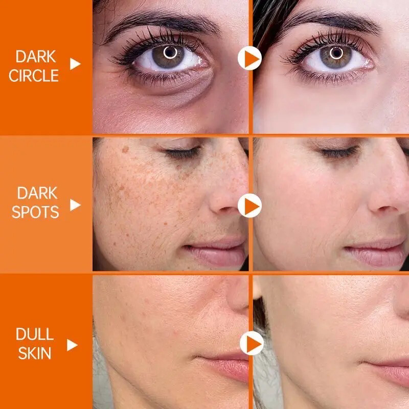 Vitamin C Whitening Skin Care Set