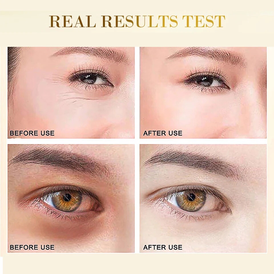 Anti Dark Circle Eye Cream