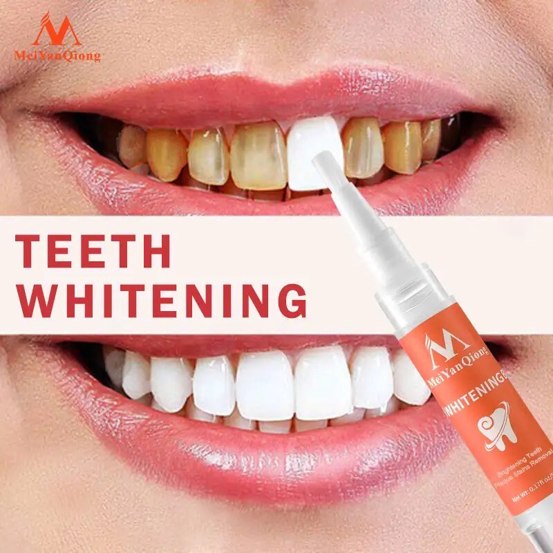 Teeth Whitening Treatment