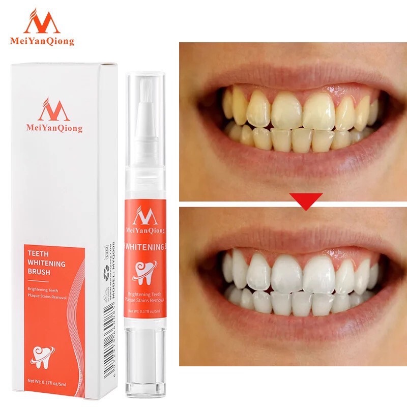 Teeth Whitening Treatment