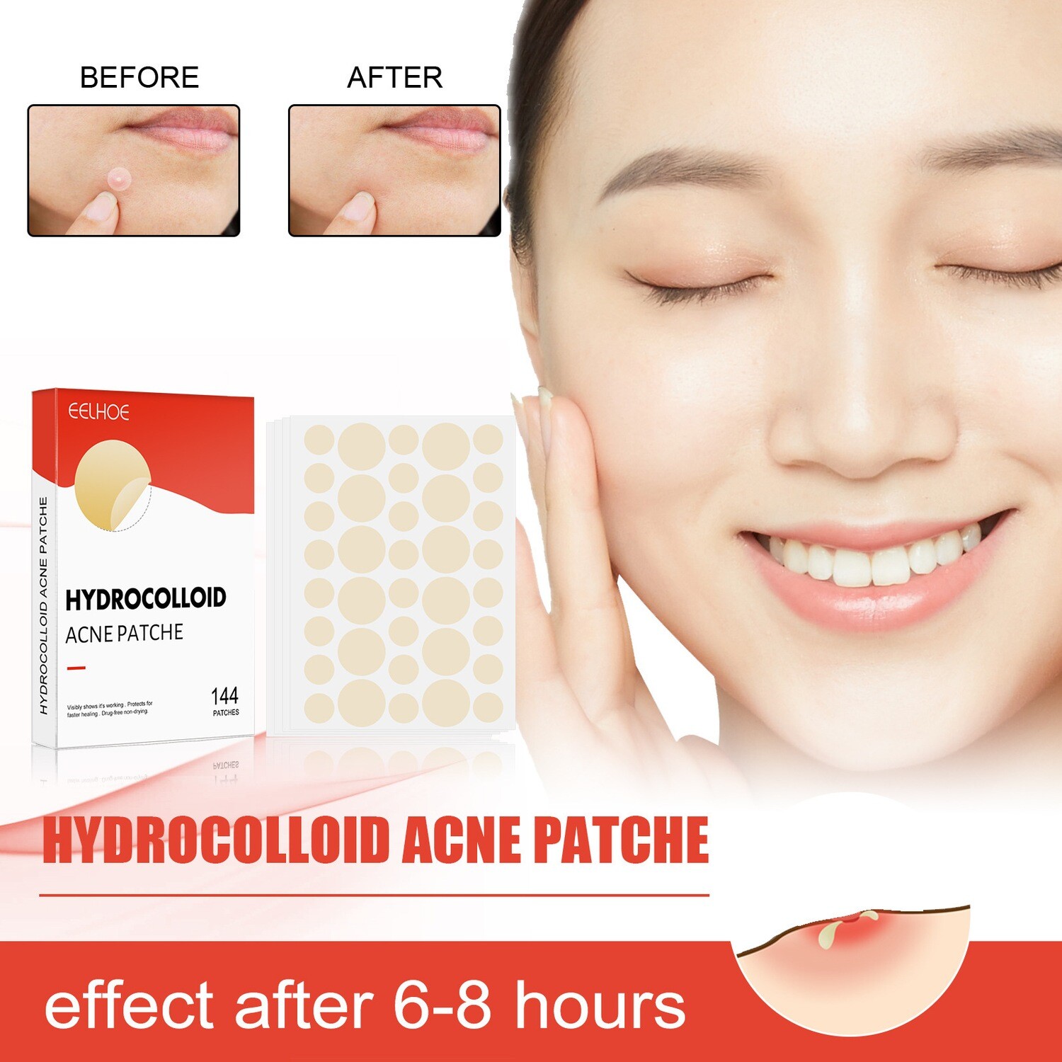 Acne Facial Invisible  Waterproof Breathable Repairing Patch