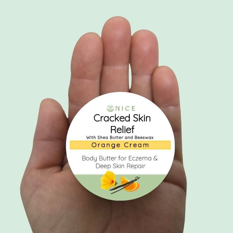 Cracked Skin Relief Cracked Skin Relief