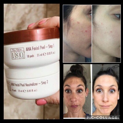 Chemical Peel