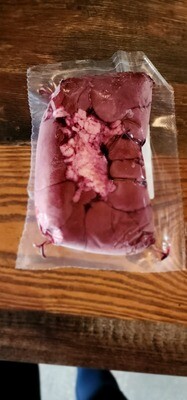 Kidney
