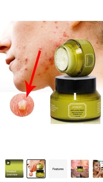 Skinfion