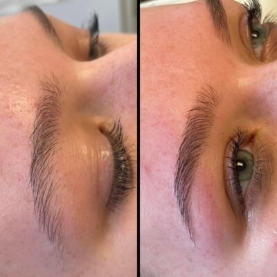 Brows