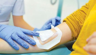 Terapia de heridas.