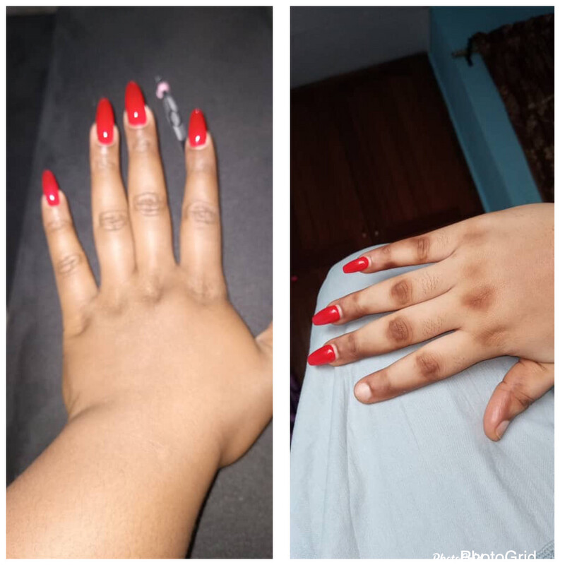 Dark knuckle Whitening oil