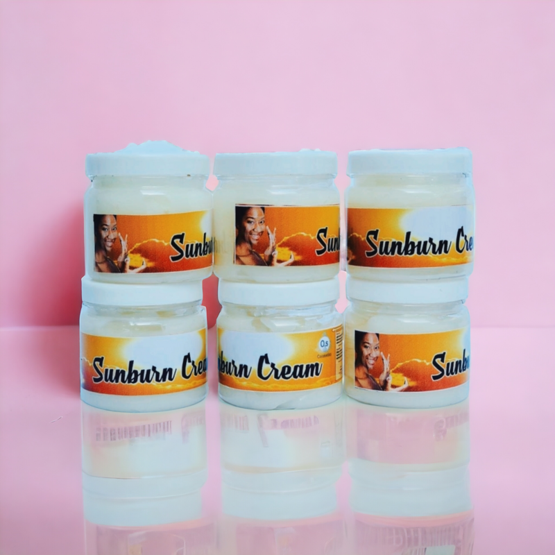 Sunburn cream