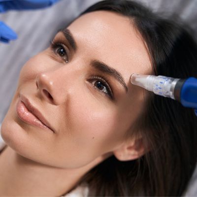 Polynucleotide Microneedling