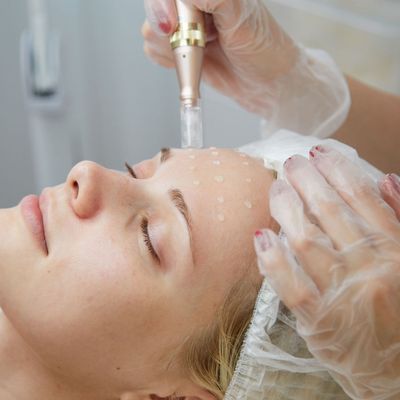 3 x Platinum Microneedling Sessions &amp; Aftercare Product