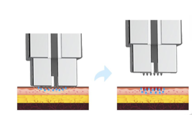 BLUE FARM | MESO ETM: Cartucce monodose meso needling ETM Face