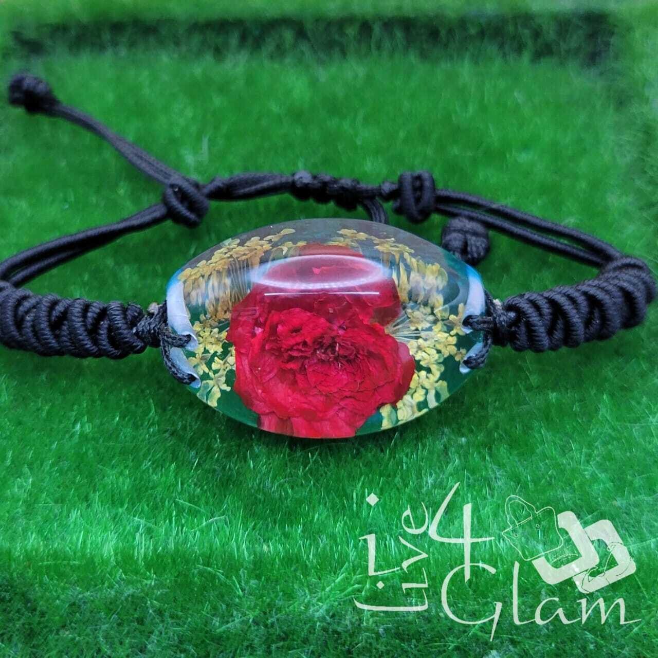 Real Flower Oval Rose Bracelet , Color: Blue/ Yellow Flower
