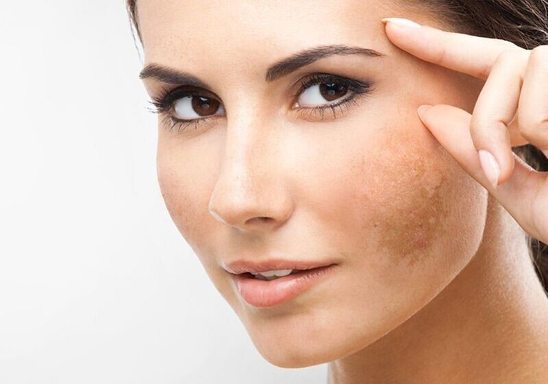 Bono 3 sesiones con Dermapen Bono 3 sesiones con Dermapen
