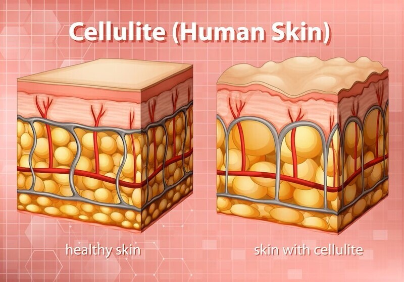 ORIGINAL Fat/Cellulite Reduction Aminophylline 2.5%/Glycyrrhetinic Acid 0.5% TOPICAL CREAM 30g with Service Fee  SOUTH LAKE PHARMACY