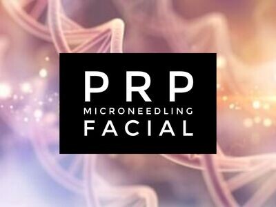 PRP Microneedling Facial