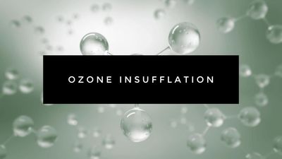 Ozone Insufflation