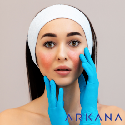 Sensitive and Reactive Skin