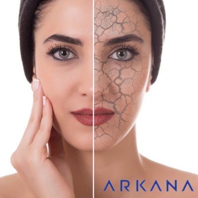 Normal, Dry and Dehydrated Skin