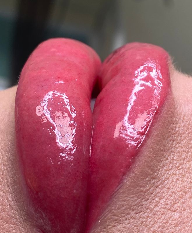 Lip Blush Before &amp; After Results