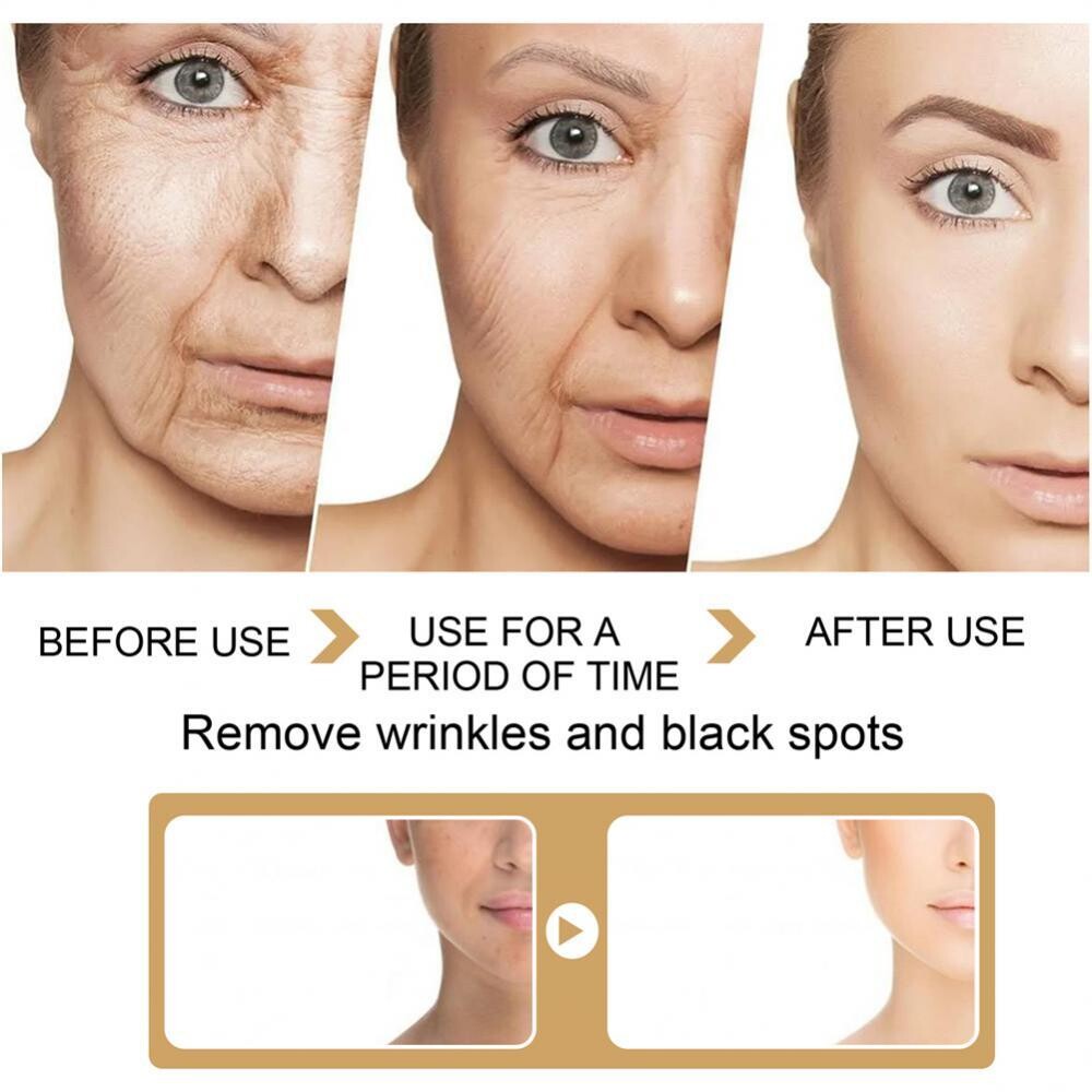 Turmeric Dark Spot Moisturizing Improve Skin Tone Witening Cream Face Care
