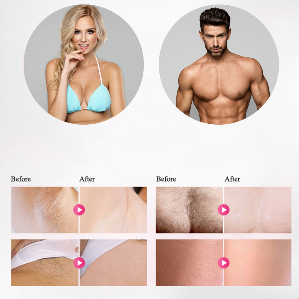 Home Hold Depilatory Laser Mini Hair Epilator Permanent Hair Removal