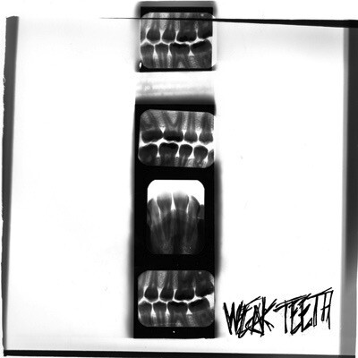 WEAK TEETH - WEAK TEETH 7''