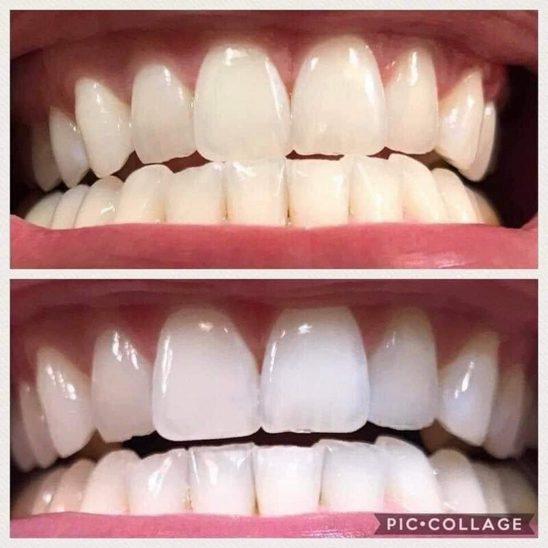 Whitening Toothpaste