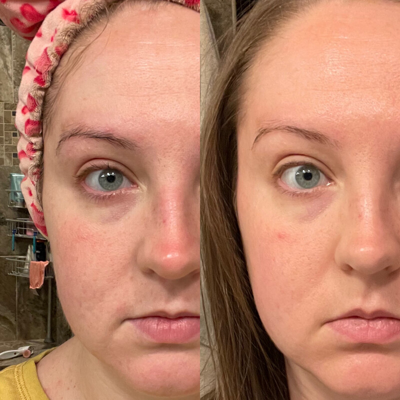 Vitamin C + Collagen Pump