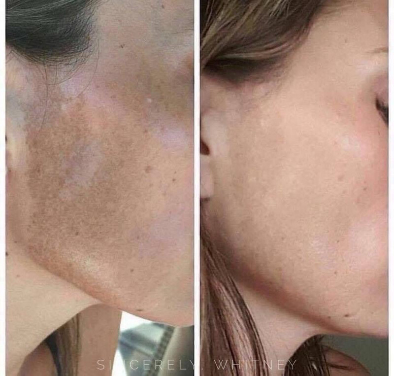 180 Vitamin C Face Wash